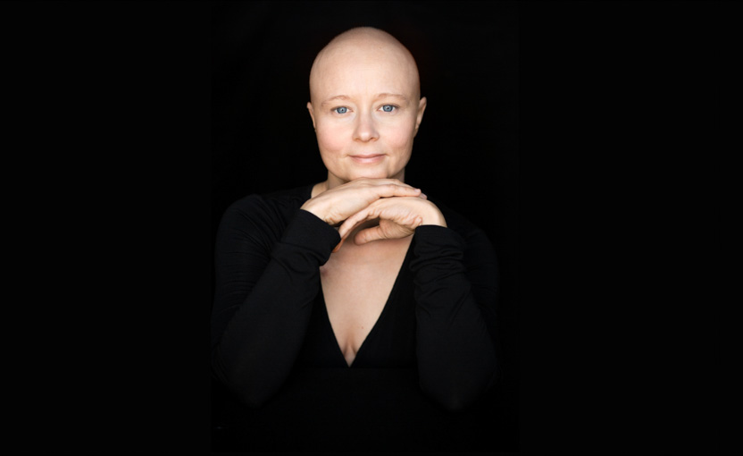 A young breast cancer patient undergoing chemotherapy; facing chemo project