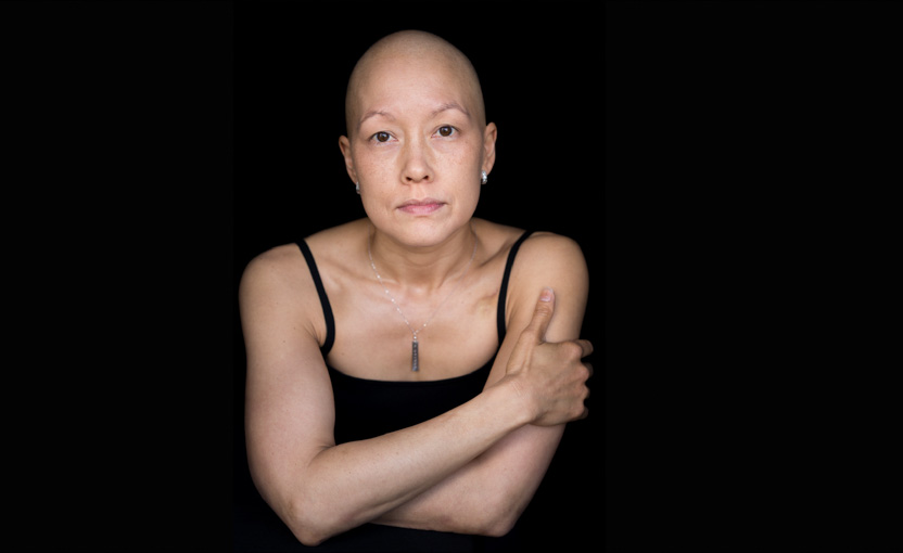 Breast cancer patient - Facing Chemo project; chemotherapy