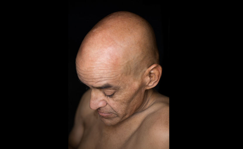 Male cancer patient undergoing chemotherapy; cancer battle; survivor; Bay Area photography, healthcare