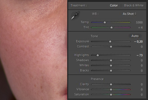 Tutorial: How to Make Freckles Stand Out with Lightroom - 500px